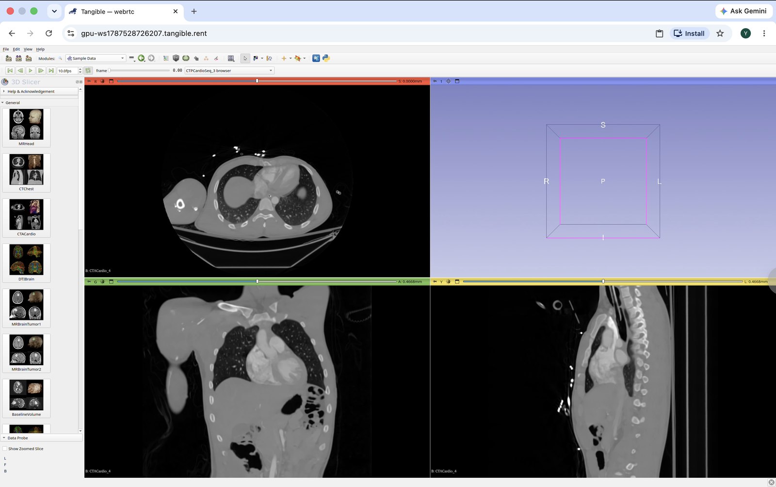 GPU-accelerated medical imaging (3D Slicer) streamed from Tangible